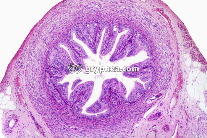 Trompe de Fallope x25 - gryphea.com